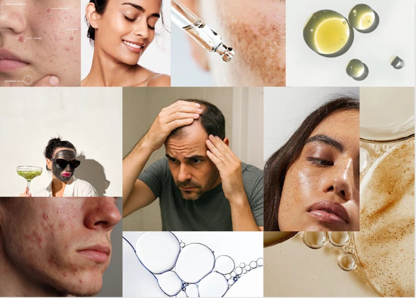 Moodboard: real skin concerns — acne, pigmentation, hair loss — and the glow after